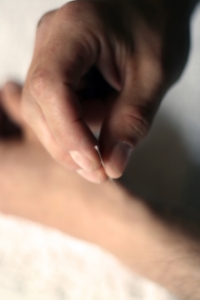 A patient receives acupuncture.